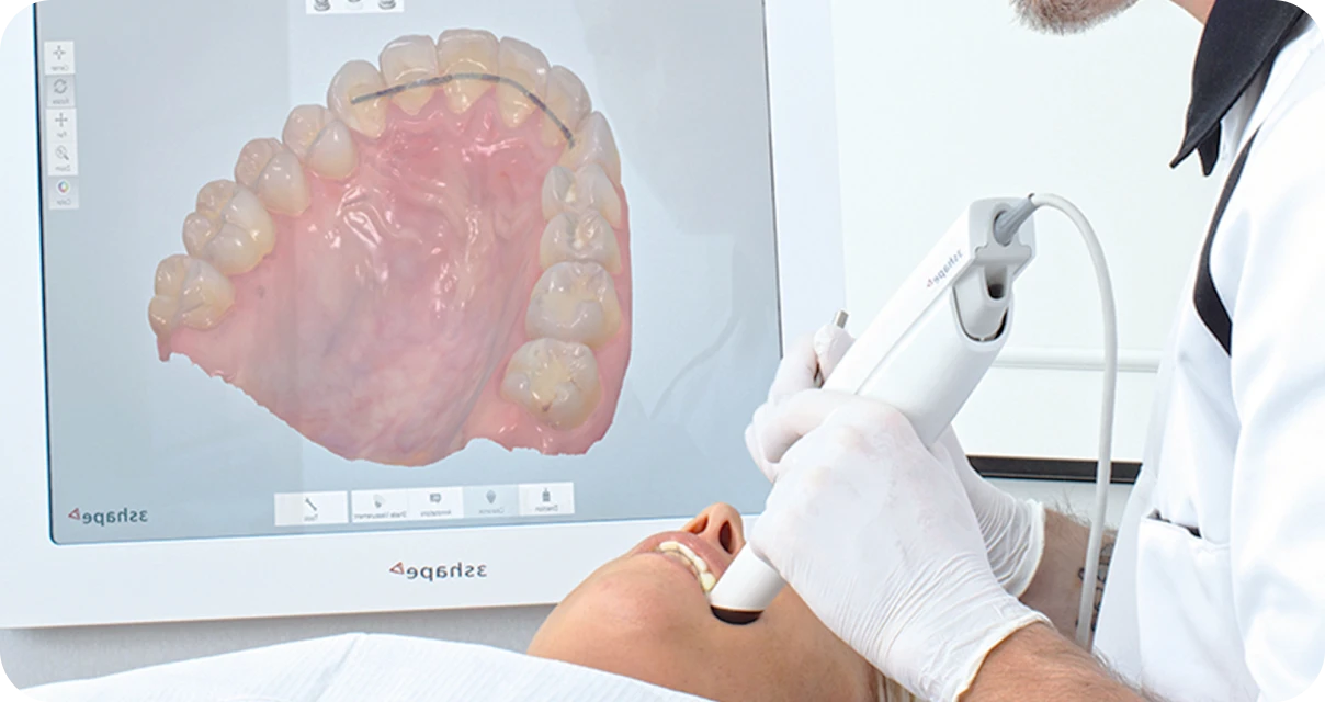 Empreinte optique au cabinet d'orthodontie Arcade à Saint-Denis à La Réunion