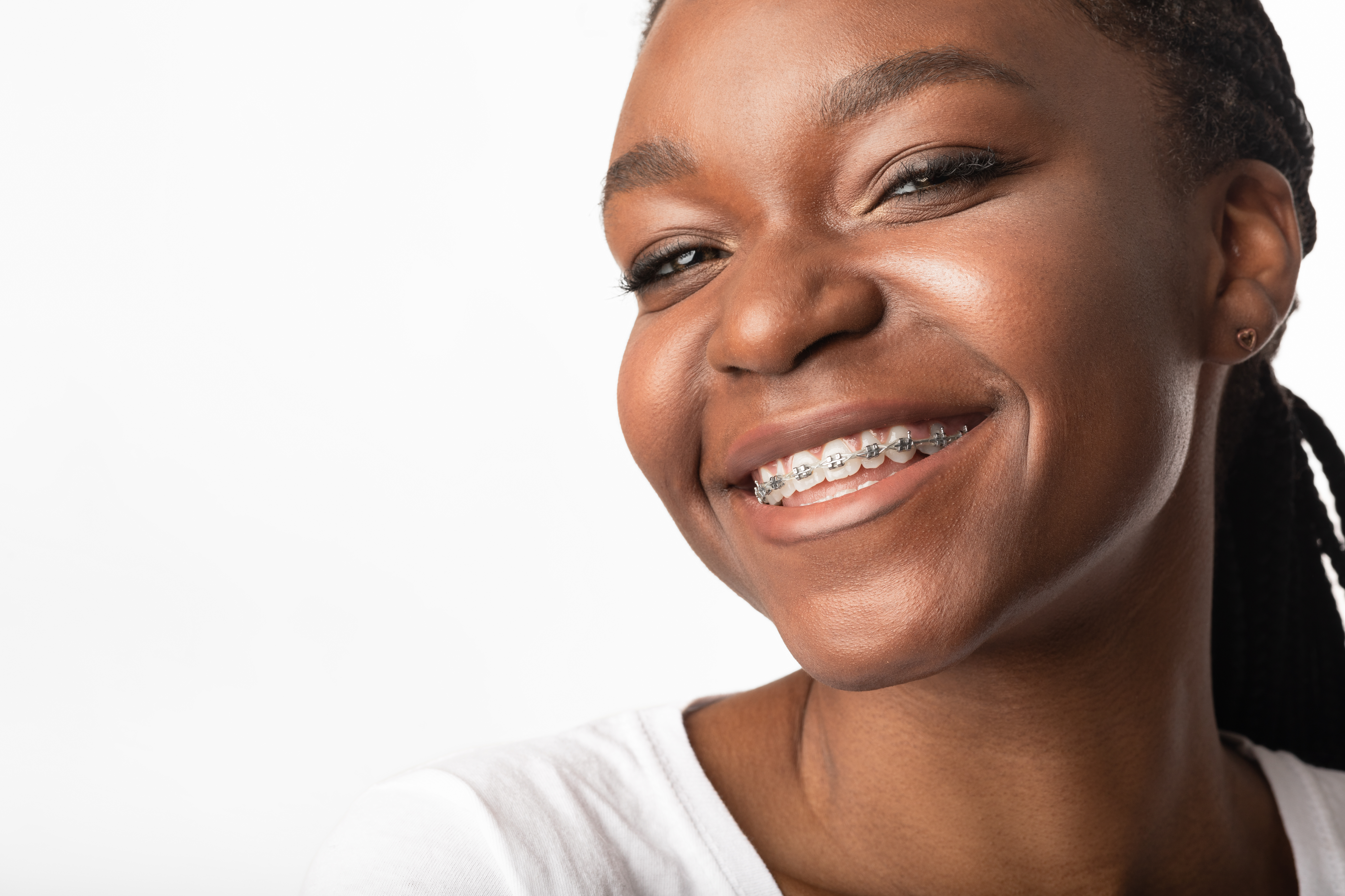 adolescente avec un appareil fixe bagues orthodontie métal
